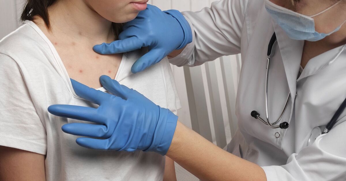 Victorian disease spreading rapidly through Europe as one country has 3,200 cases